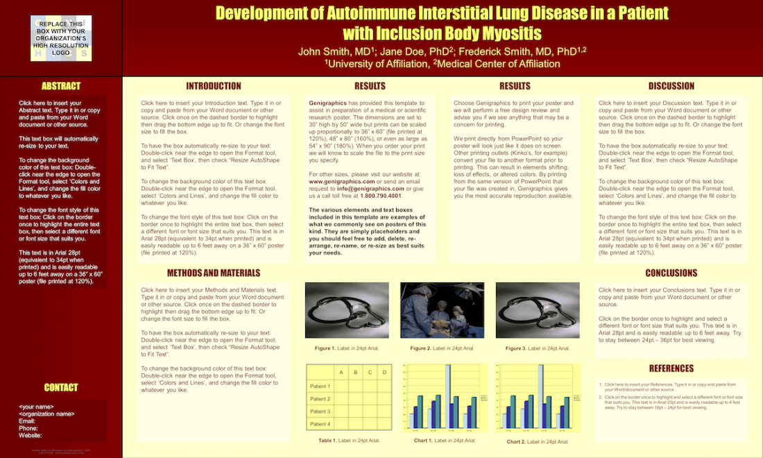 Development of Autoimmune Interstitial Lung Disease in a Patient with Inclusion Body Myositis